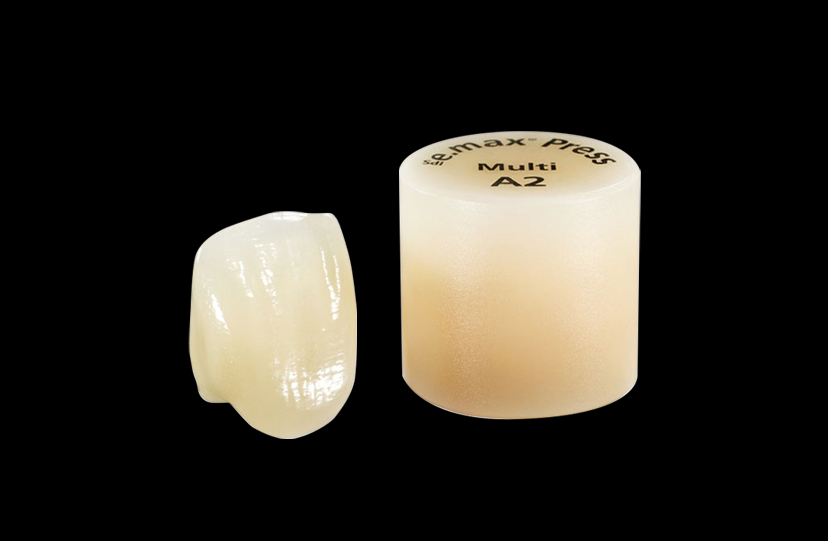 IPS e.max Press